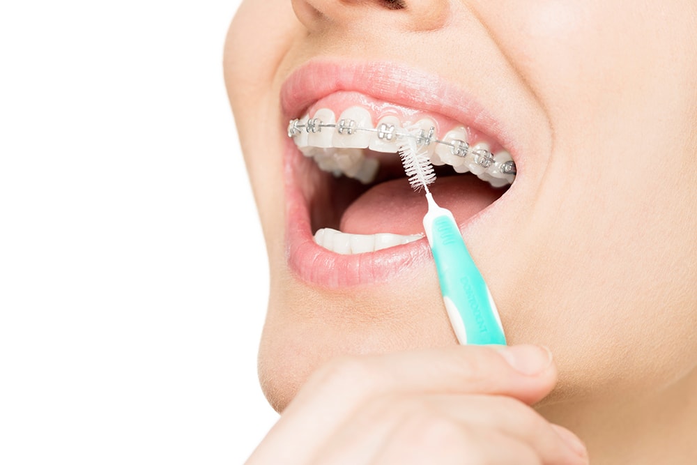 Interdental toothbrush