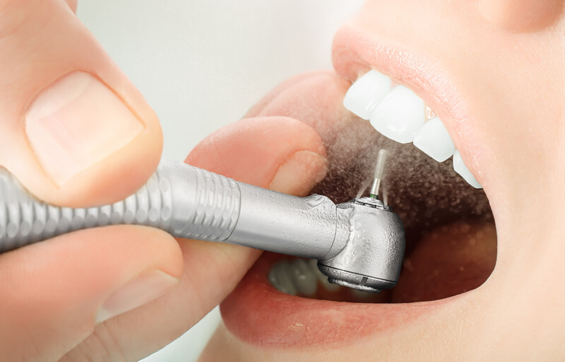 What Does A Teeth Cleaning Treatment Feel Like