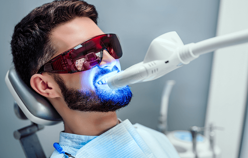 Man getting his teeth professionally whitened
