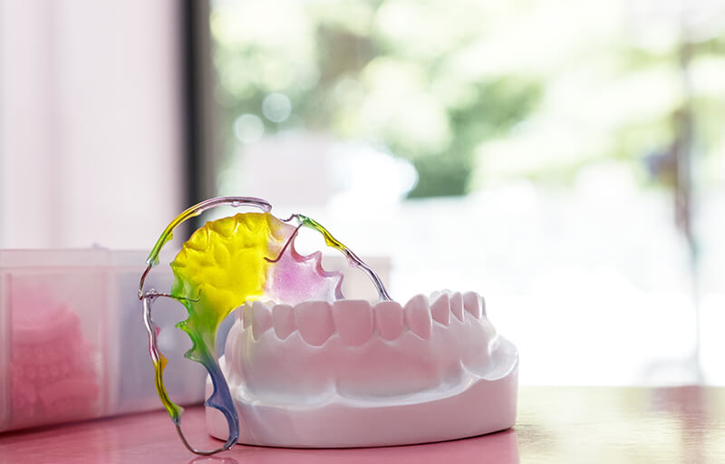 Image for Article: Do I Need to Wear a Retainer?