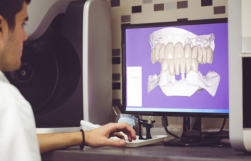 Image for Article: Bone Grafting for Dental Implants