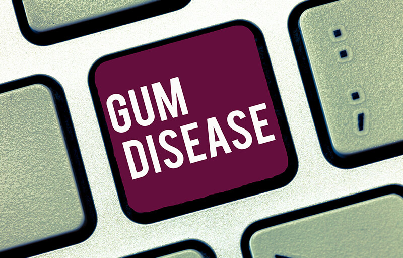 Image for Article: Gum Abscesses: Symptoms, Causes, and Treatment Options